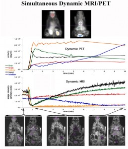 Simultaneously acquired dynamic MRI and PET data following the injection of Gadolinium MRI contrast agent and the PET tracer 18F-FDG. Top two PET images illustrate positions of the regions of interest used to measure the dynamic uptake of the FDG shown in the top plot. Bottom three pairs of images are representative pairs of images acquired before (left pair), just after (middle pair) and 10 min post gadolinium injection with regions of interest used to generate the dynamic MRI data (bottom plot).