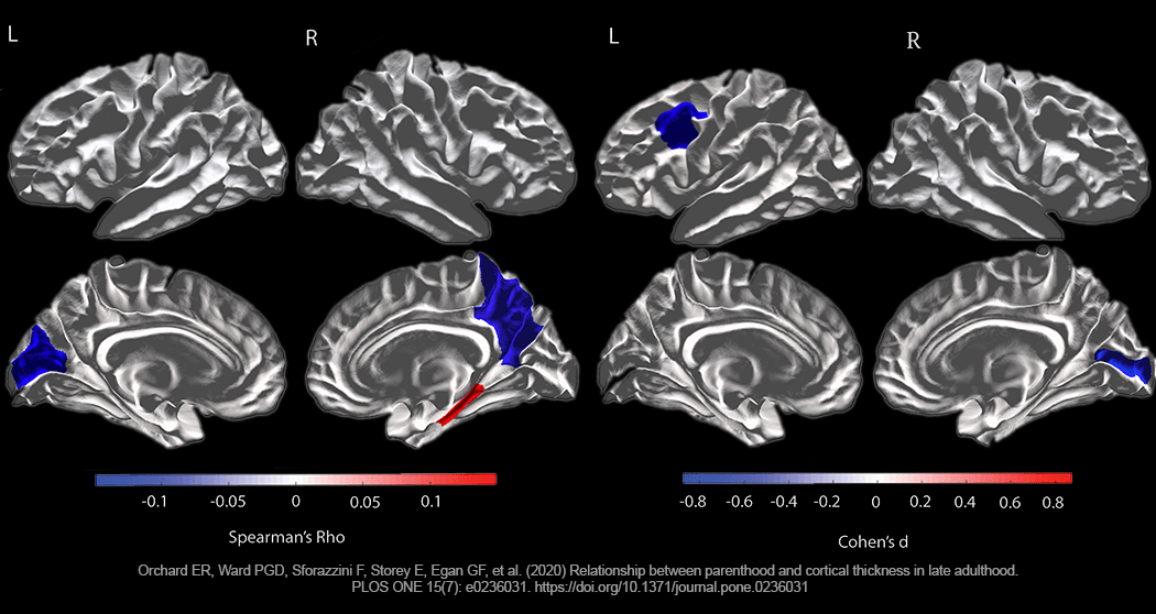 MRI brain slices with regions highlighted showing changes between females with and without children - from PLOSOne
