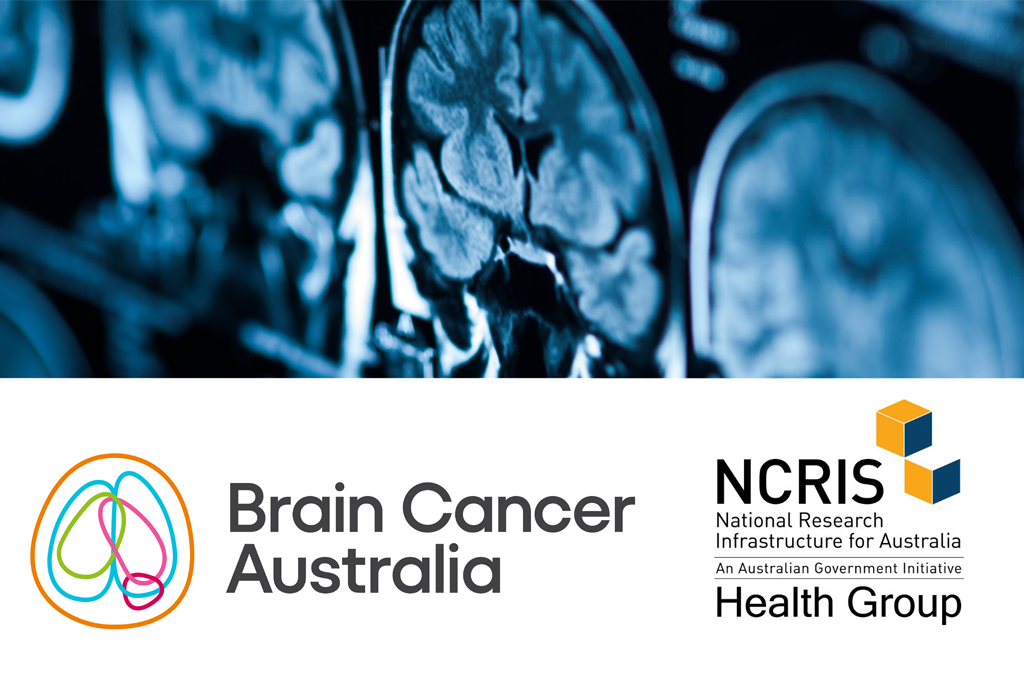 Australian health research infrastructure underpins world-first brain cancer collaboration