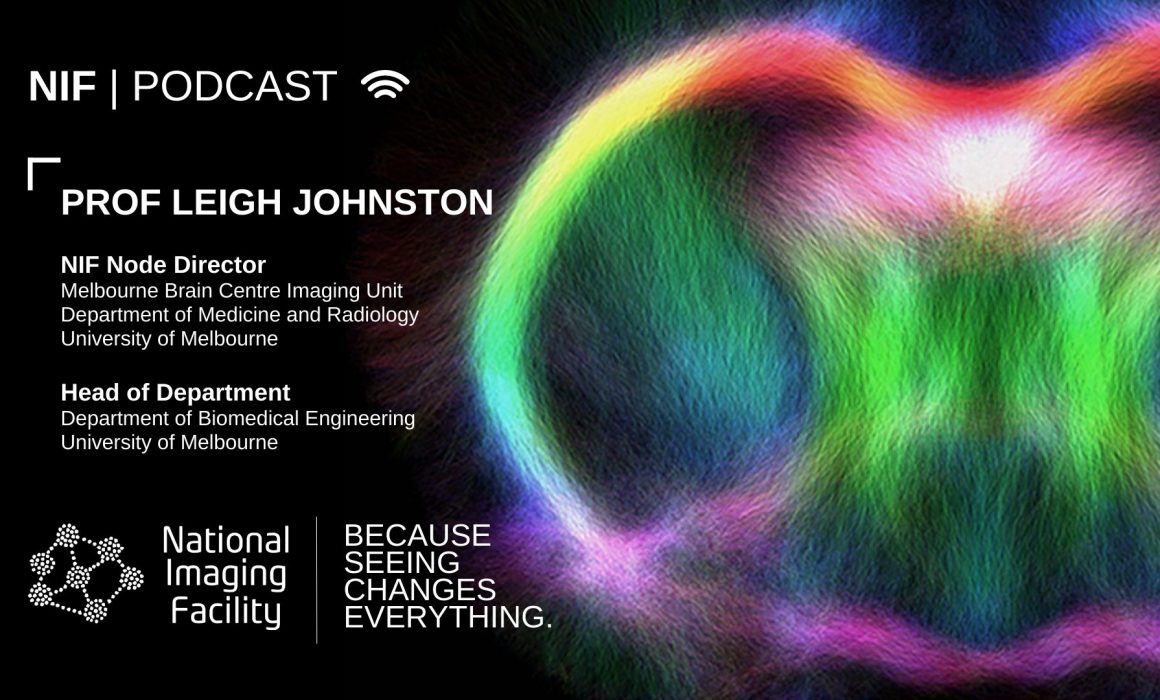 #IWD | PODCAST: In conversation with Professor Leigh Johnston