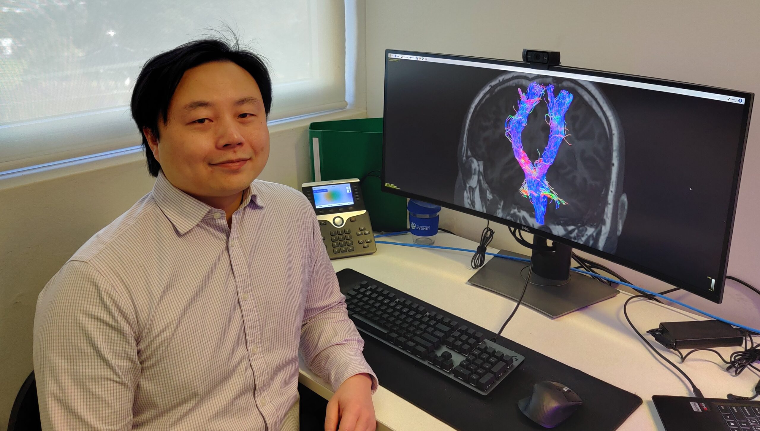 Network models brain changes in motor neurone disease to develop imaging tools for clinicians