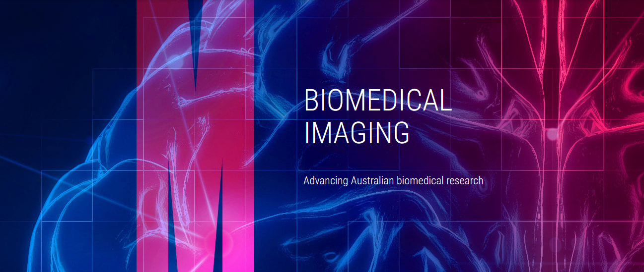 PAST: Monash Biomedical Imaging Webinar: Decoding experiences – Synaesthesia and beyond