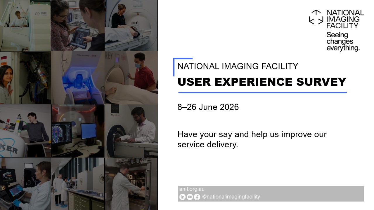 NIF user communities: we want your feedback