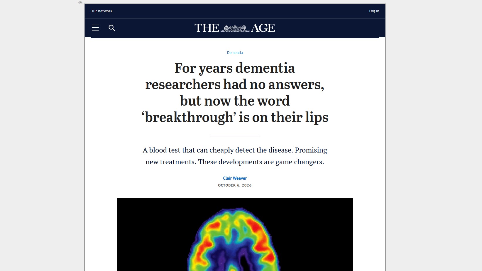 Imaging remains crucial: Alzheimer’s breakthrough doesn’t end with a blood test